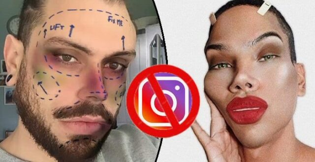 instagram filtri chrirugia estetica